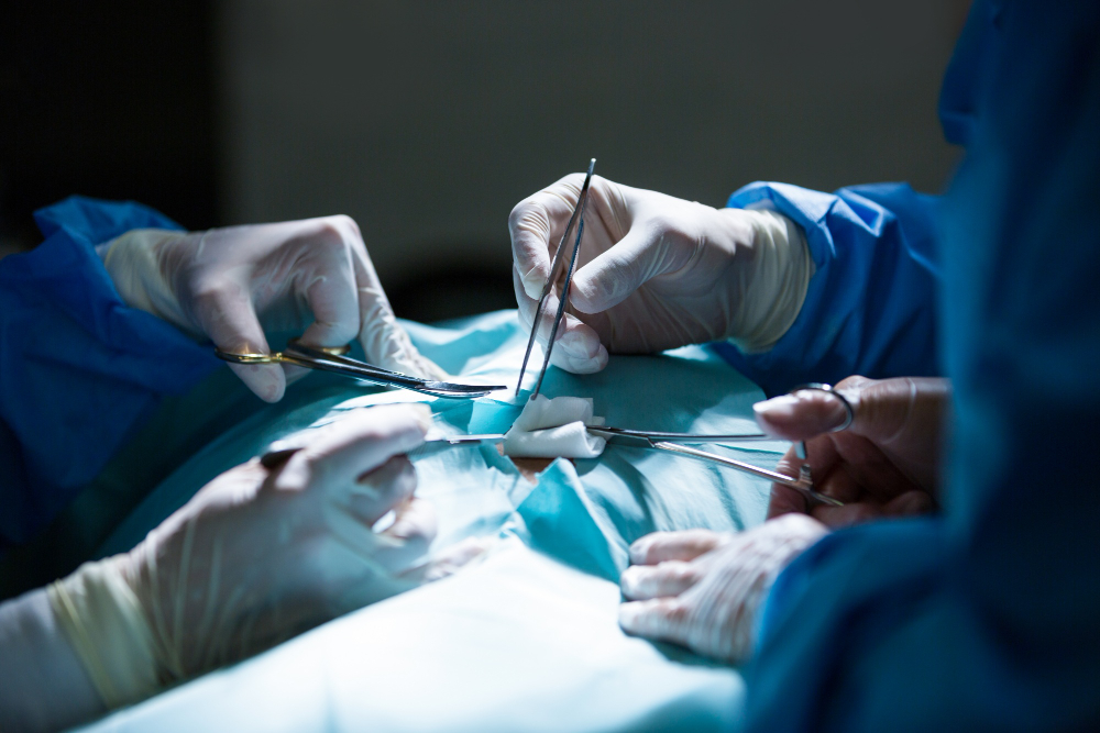 Undergoing a Gynecomastia Surgery